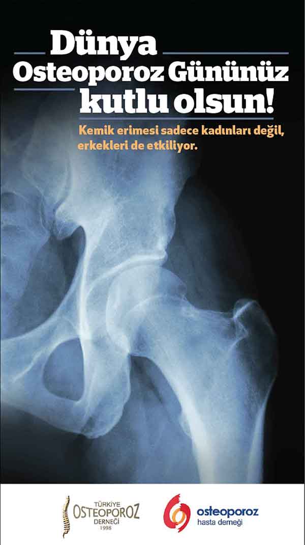 Posta Gazetesi Osteoporoz Ticari İlan Örneği